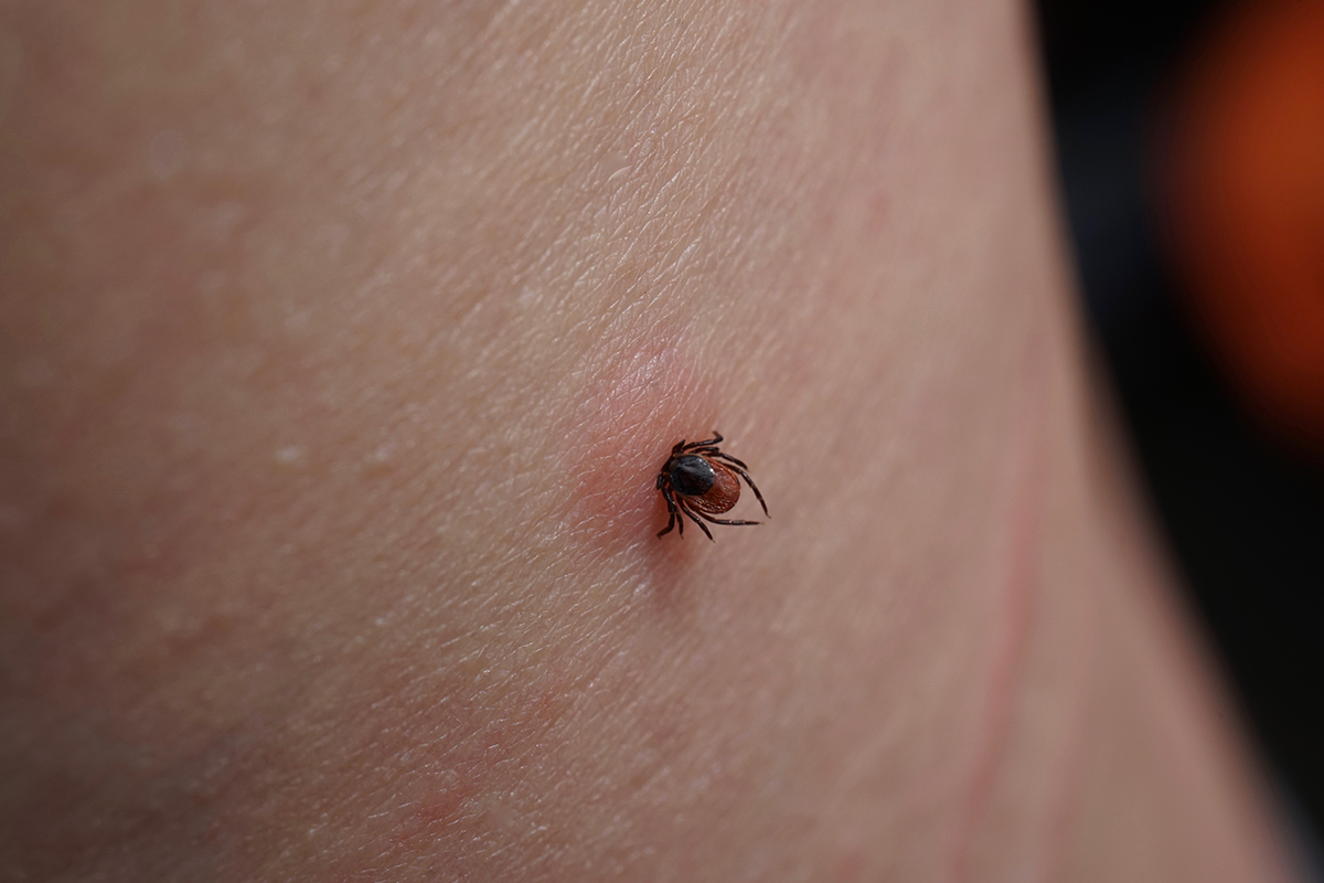 Tips and Ticks: Tick Bites, Safety, and Prevention for Humans and Dogs 7
